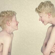 Sposoby leczenia bielactwa nabytego