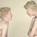 Sposoby leczenia bielactwa nabytego