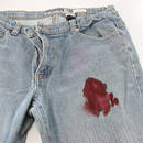 Prosty sposób na usunięcie z odzieży plam z krwi