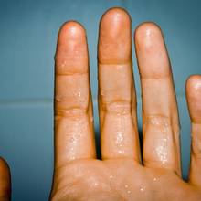 Jak wyleczyć potliwość rąk za pomocą herbaty?