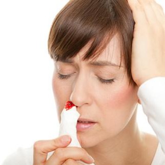 Jak postępować w przypadku krwotoku z nosa?