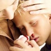 Czy krwawienie z nosa to powód do niepokoju?