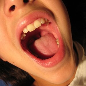 Oszczędzanie głosu