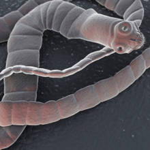 Jakie są główne objawy zarażenia tasiemcem?