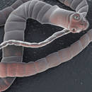 Jakie są główne objawy zarażenia tasiemcem?