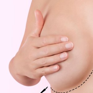 Wciągnięte brodawki sutkowe