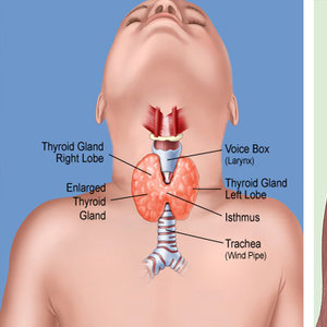 Zdiagnozowanie guzków