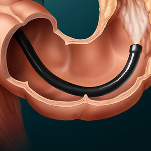 Konsultacja medyczna