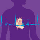 Objawy i leczenie migotania przedsionków