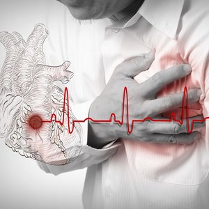 Migotanie bez powodu