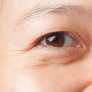 Jak zlikwidować worki pod oczami?