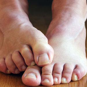 Przyczyny zespołu niespokojnych nóg