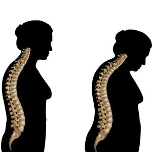 Zaokrąglenie pleców