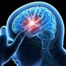 Jak chronić się przed udarem mózgu?