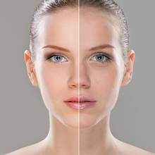 Proste sposoby na zmatowienie cery