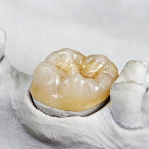 Jak przebiega zabieg?