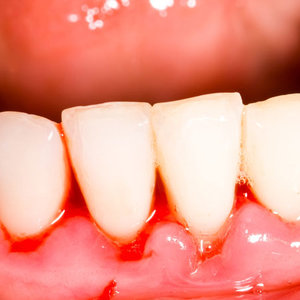 Napar z tymianku i szałwii