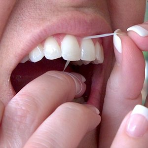 Czystość i rodzaj nitki