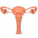 Skuteczny sposób leczenia policystycznych jajników